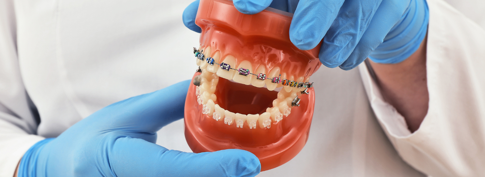 Orthodontic Treatment Illustration